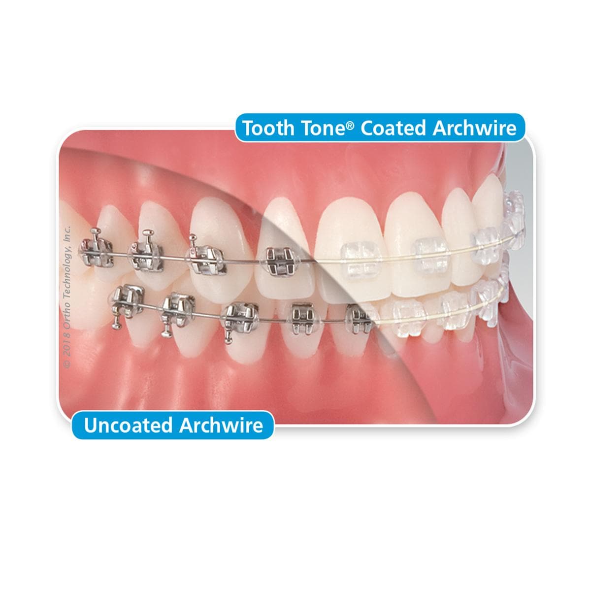 Tooth Tone® beschichtete Nickel-Titan-Drahtbögen - Full-Form, rechteckig, geätzt - OK, .016" x .022"