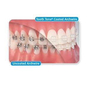 Tooth Tone® beschichtete Nickel-Titan-Drahtbögen - Full-Form, rechteckig, geätzt - UK, .018" x .018"