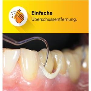 3M RelyX™ Universal Befestigungskomposit - Nachfüllpackung - Transluzent, Spritze 3,4 g