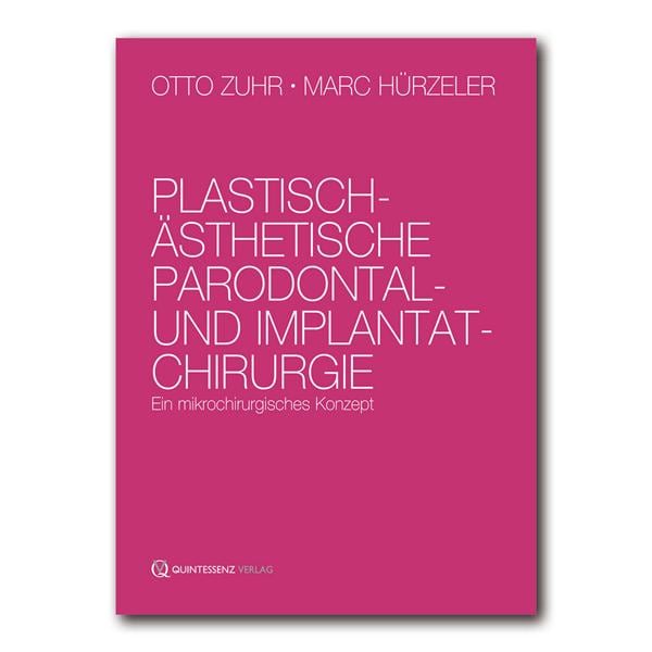 Plastisch - Ästhetische Parodontal- und Implantatchirurgie - Buch