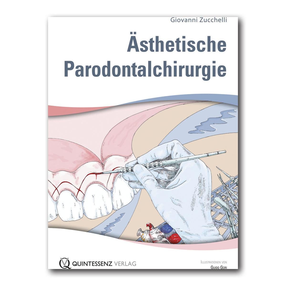 Ästhetische Parodontalchirurgie - Stück
