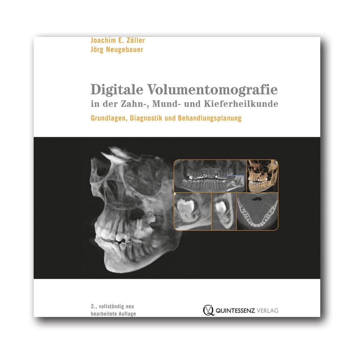 Digitale Volumentomografie in der Zahn-, Mund- und Kieferheilkunde - Buch